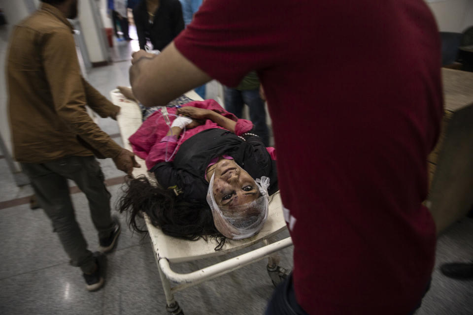 A wounded woman is carried on a stretcher for treatment after she was injured in a bus accident, at a local hospital in Srinagar, Indian controlled Kashmir, June 27, 2019. A minibus carrying students to a picnic fell into a gorge along a Himalayan road in Indian-controlled Kashmir, killing more than 10 and injuring several others. The image was part of a series of photographs by Associated Press photographers which won the 2020 Pulitzer Prize for Feature Photography. (AP Photo/Dar Yasin)