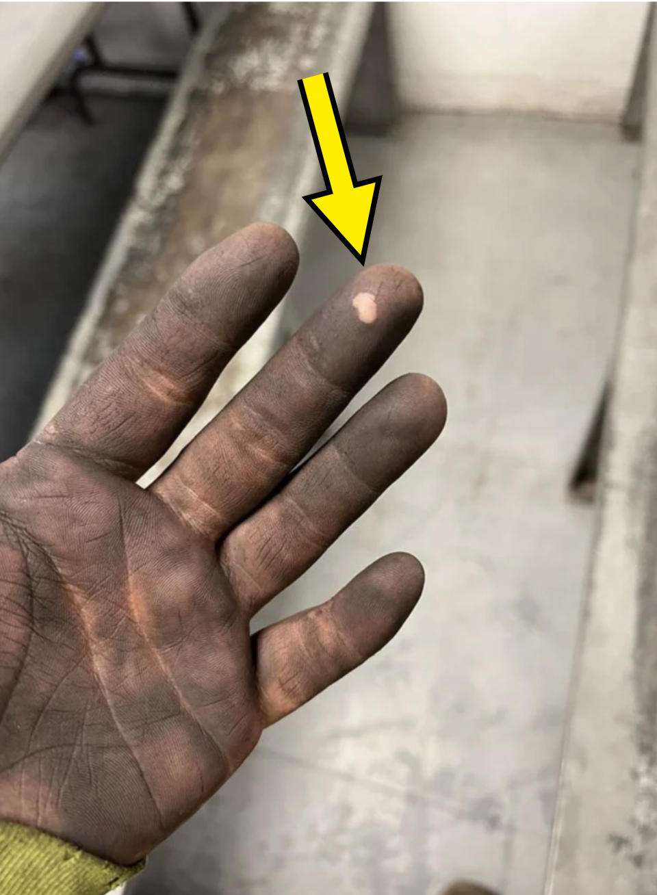 dirty hand with small spot that's not dirty