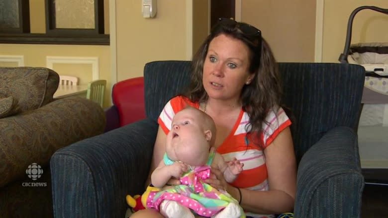 Manitoba baby girl with rare neck growth gets help from around the world