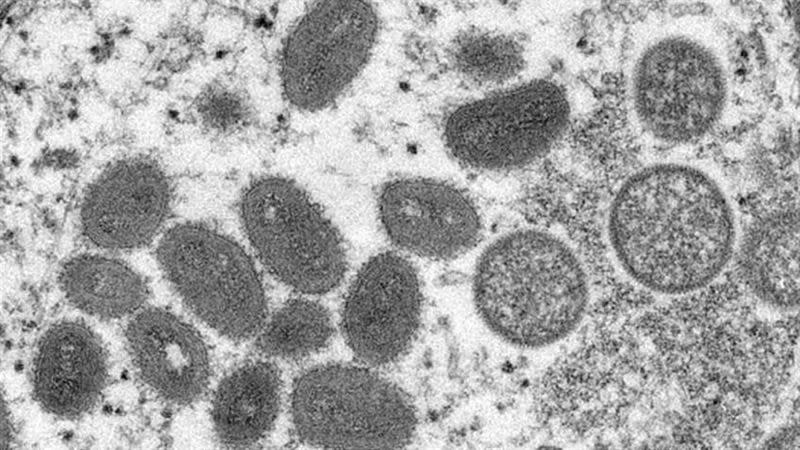 全台猴痘確診已7例遍及南北，散發流行（圖／翻攝自美國疾管制與預防中心網頁cdc.gov）