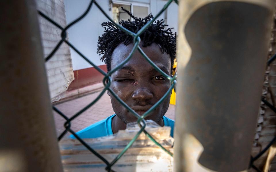 A migrant with an eye injury in the temporary centre for immigrants and asylum seekers in Melilla on June 25 - Fadel Senna/AFP