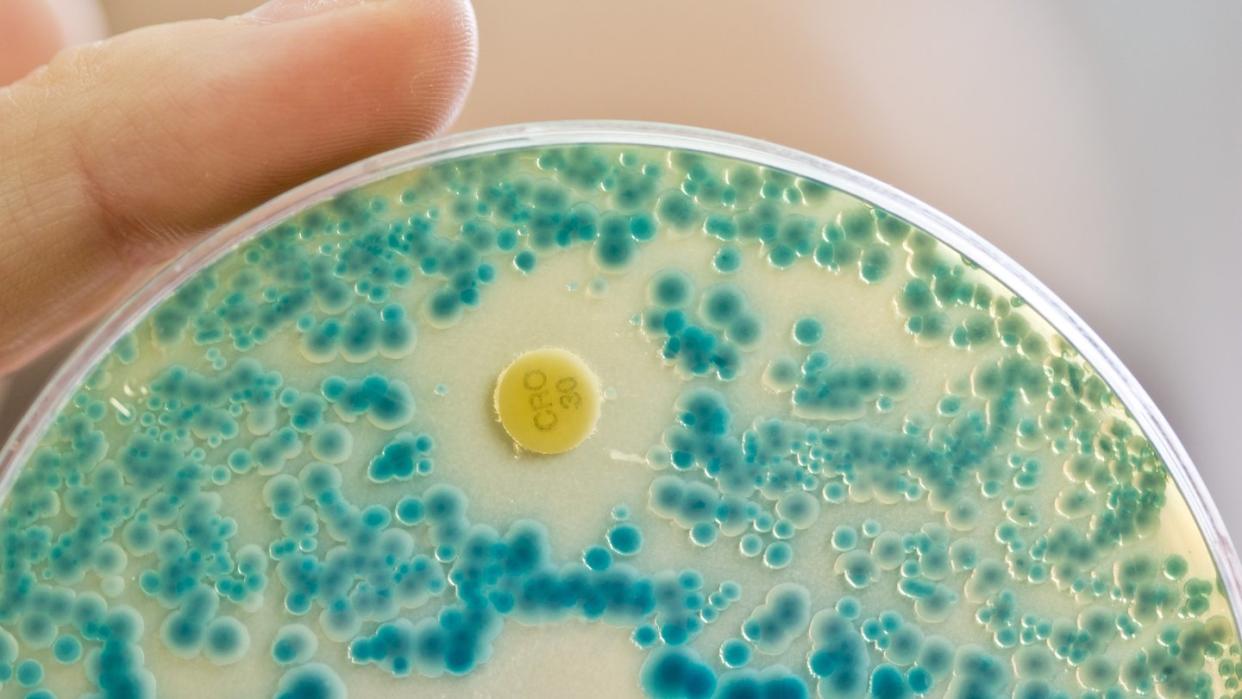 Indikatorkulturplatte zum Nachweis von resistenten Bakterien. Dem UN-Bericht zufolge werden bis 2050 voraussichtlich gegen Antibiotika widerstandsfähige Infektionen weltweit die größte Todesursache sein. Foto: Daniel Karmann/Archiv