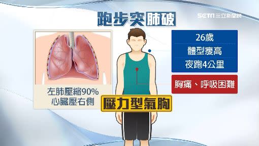 該男子送醫後診斷為「壓力型氣胸」。