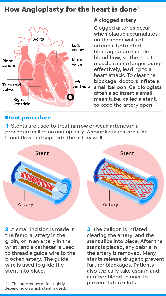 SOURCE National Institutes of Health; National Heart, Lung and Blood Institute; USA TODAY research