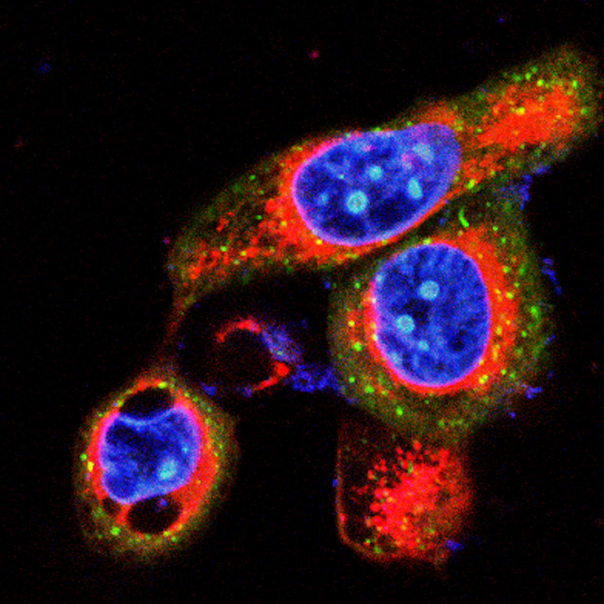 Células de cáncer de páncreas en proceso de autofagia. Imagen obtenida por nuestro grupo de investigación. Author provided