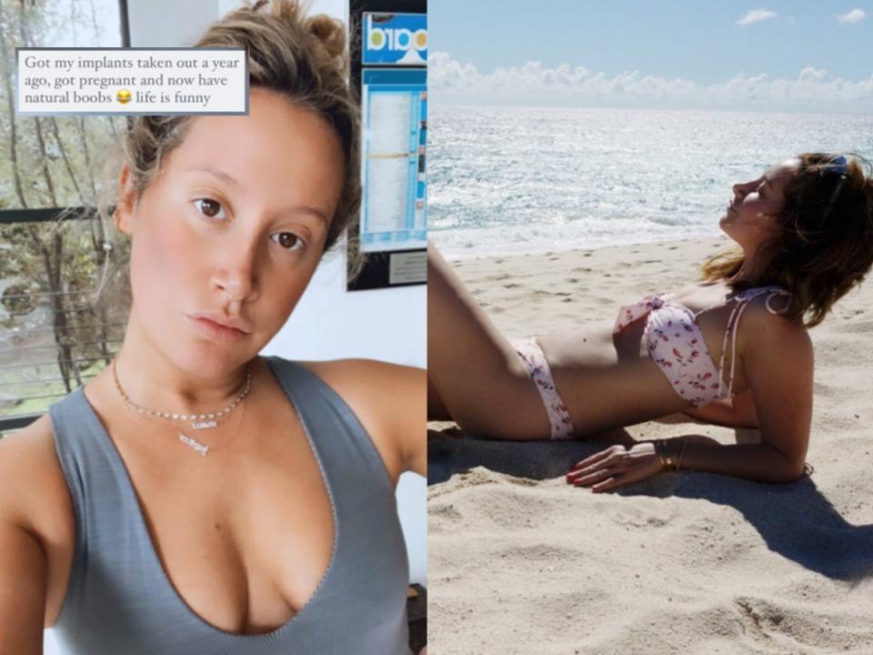 Ashley Tisdale had her breast implants removed a year ago.