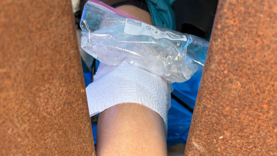 Aid worker Adriana Jasso said she had to treat a Colombian woman’s injured knee through the fence, since some migrants end up trapped between the primary and secondary border walls. Jasso said the woman told her she was four months pregnant. - Courtesy Adriana Jasso/AFSC