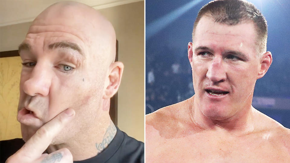 Lucas Browne says he can't hear out of one of his ears following his brutal knockout at the hands of Paul Gallen in their heavyweight bout on Wednesday night. Pictures: Instagram/lucasbigdaddybrowne/Getty Images