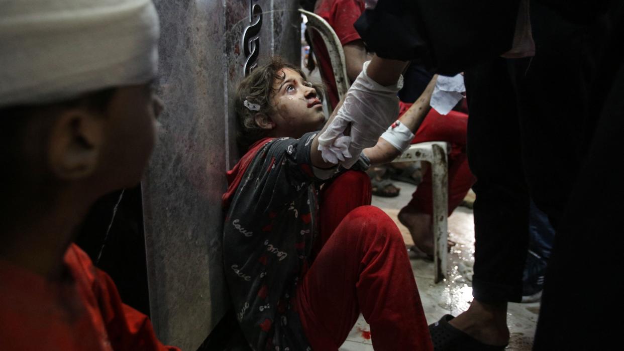  A young girl is treated at Al-Shifa hospital. 