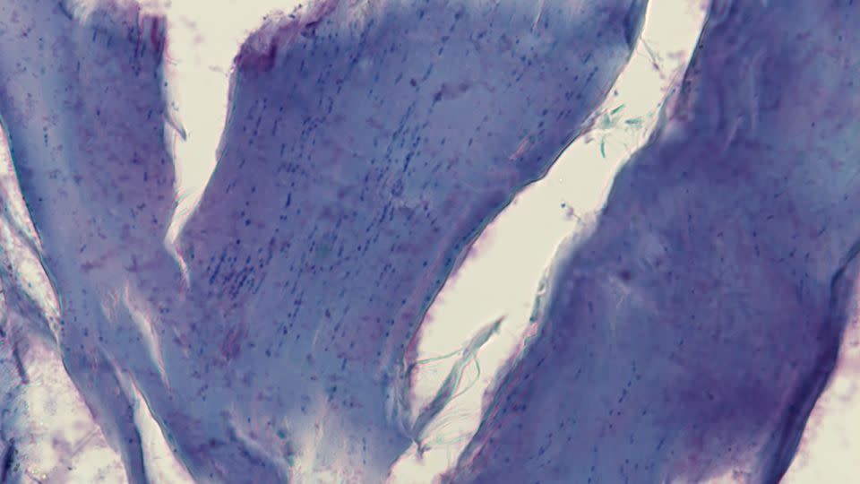 A microscope image of subdermal muscle from the ancient skin shows remnants of mammoth nuclei. The new study revealed that fossils of ancient chromosomes survive in this skin sample. - Elena Kizilova/Institute of Cytology and Genetics SB RAS