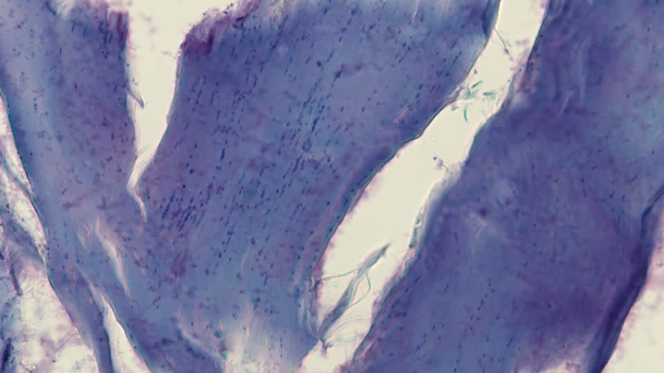 A microscope image of subdermal muscle from ancient skin shows remnants of mammoth nuclei. The new study revealed that fossils of ancient chromosomes survive in this skin sample. - Elena Kizilova/Institute of Cytology and Genetics SB RAS