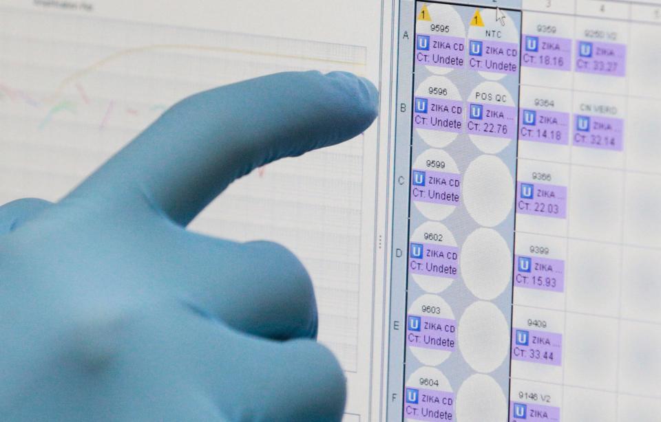 FILE - In this Thursday, Feb. 4, 2016, file photo, a medical researcher uses a monitor that shows the results of blood tests for various diseases, including Zika, at the Gorgas Memorial laboratory in Panama City. On Thursday, April 28, 2016, the U.S. Food and Drug Administration authorized Quest Diagnostics to offer the first commercial test for the Zika virus in the United States. Previously, Zika tests were only available through a handful of government-designated laboratories. Quest said the commercial test could be available as early as the first week of May. (AP Photo/Arnulfo Franco, File)