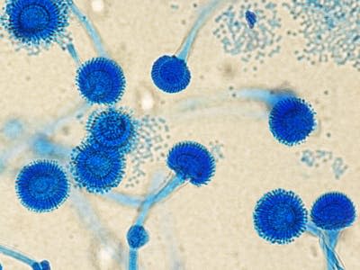 Vista al microscopio del hongo ‘Aspergillus fumigatus’. <a href="https://commons.wikimedia.org/wiki/File:Antonio_e_Biagio_e_Cesare_Arrigo_Aspergillus_fumigatus_01.jpg" rel="nofollow noopener" target="_blank" data-ylk="slk:Wikimedia Commons;elm:context_link;itc:0;sec:content-canvas" class="link ">Wikimedia Commons</a>, <a href="http://creativecommons.org/licenses/by/4.0/" rel="nofollow noopener" target="_blank" data-ylk="slk:CC BY;elm:context_link;itc:0;sec:content-canvas" class="link ">CC BY</a>