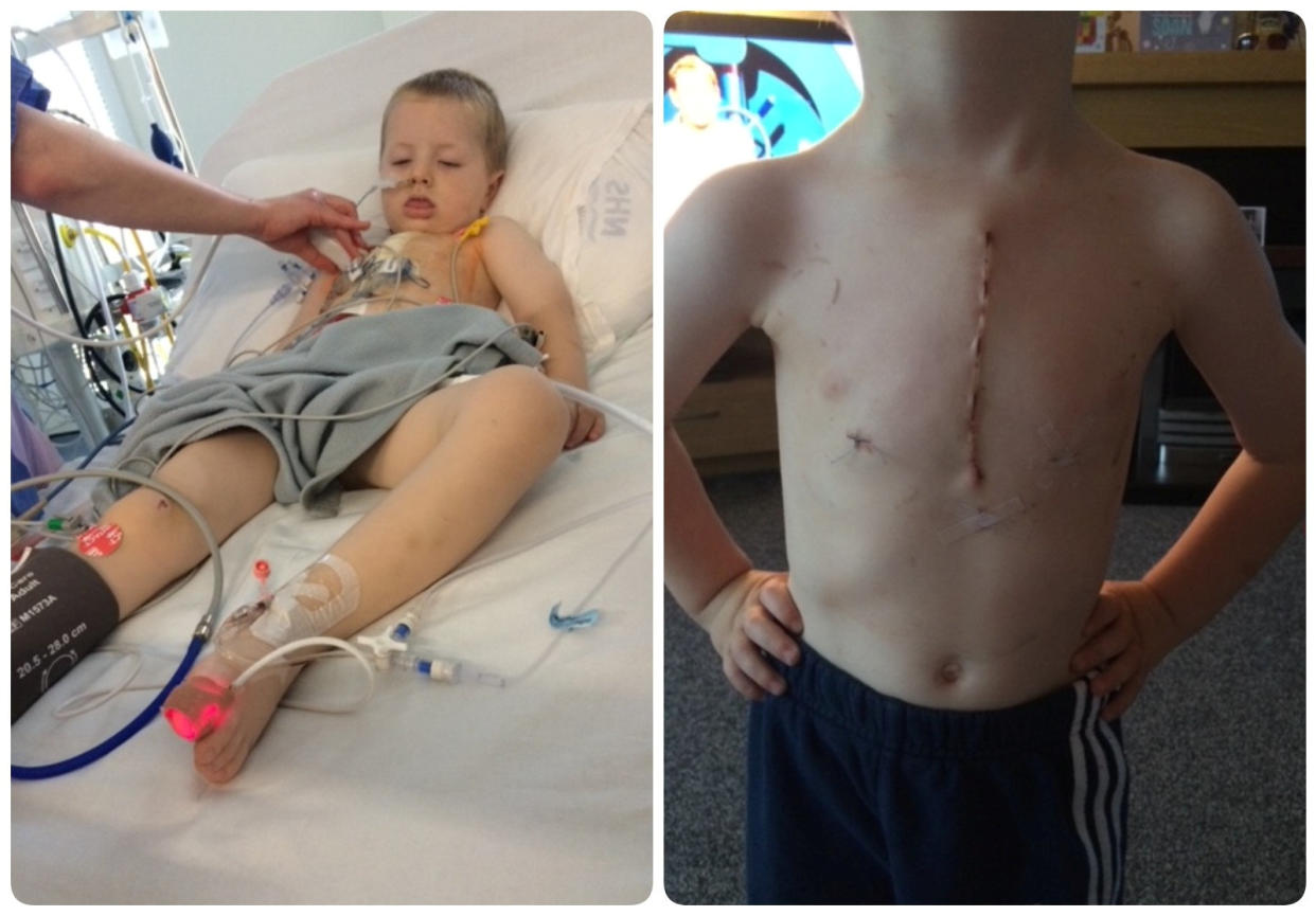 Jordy Gordon's lung collapsed after he unknowingly inhaled a popcorn kernel. (Shona Macgillivray/SWNS)