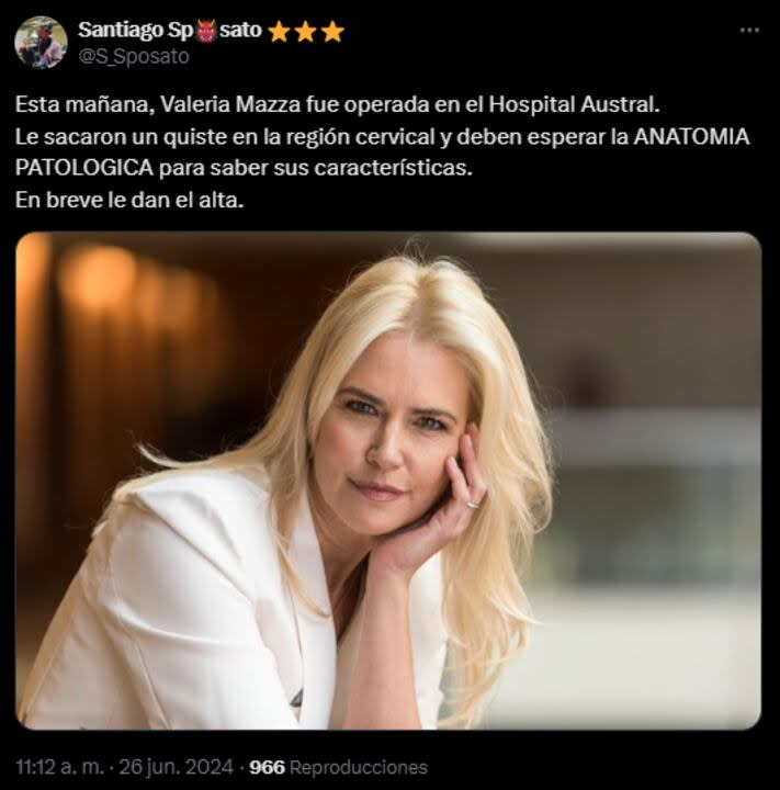 El periodista Santiago Sposato comunicó que a Valeria Mazza le sacaron un quiste en la región cervical (Foto: X @S_Sposato)