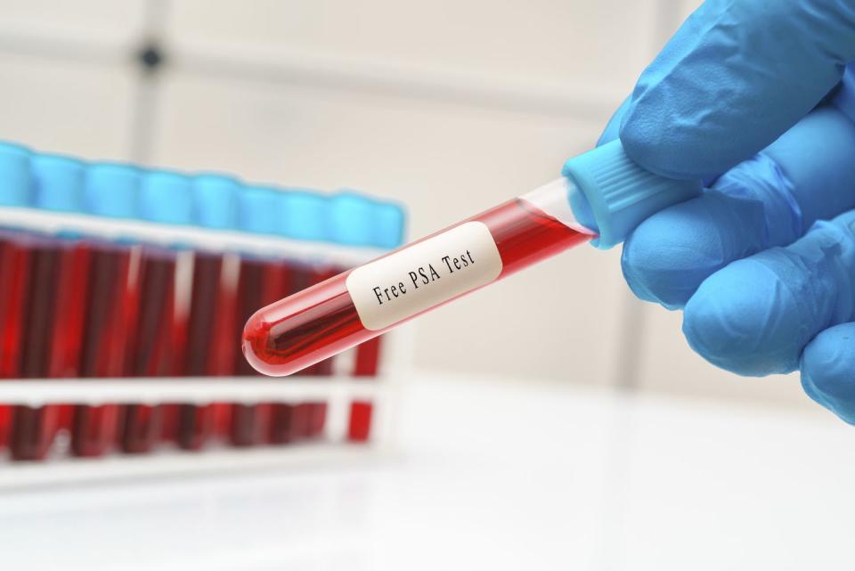 prostate cancer blood test, conceptual image