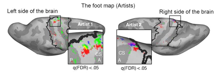 <span class="caption">The foot artists showed clear maps of individual toes in the foot area of the brain.</span> <span class="attribution"><span class="source">Reproduced with authors' permission</span></span>
