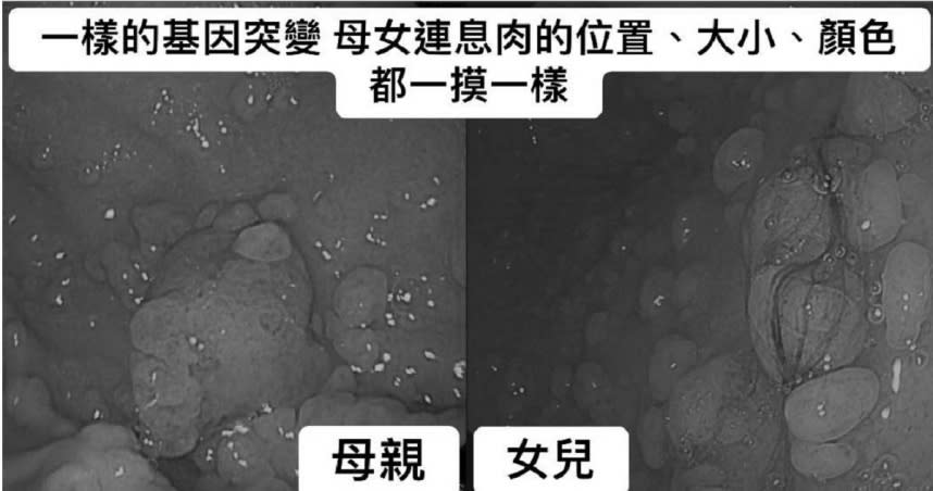 （圖／翻攝自Facebook／胰臟醫師 林相宏 禾馨民權內科診所）