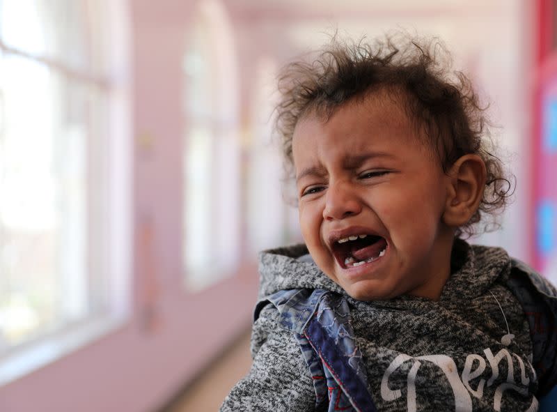 A child cries at malnutrition treatment ward of al-Sabeen hospital in Sanaa