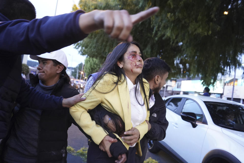 A bloodied woman is carried away after presidential candidate Fernando Villavicencio was shot to death while at a campaign rally outside a school in Quito, Ecuador, Wednesday, Aug. 9, 2023. (API via AP)