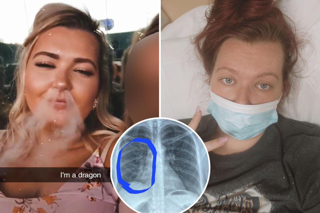 A 30-year-old Tennessee mom who picked up vaping early in the COVID-19 pandemic claims the habit nearly killed her, with a doctor reportedly saying it was 