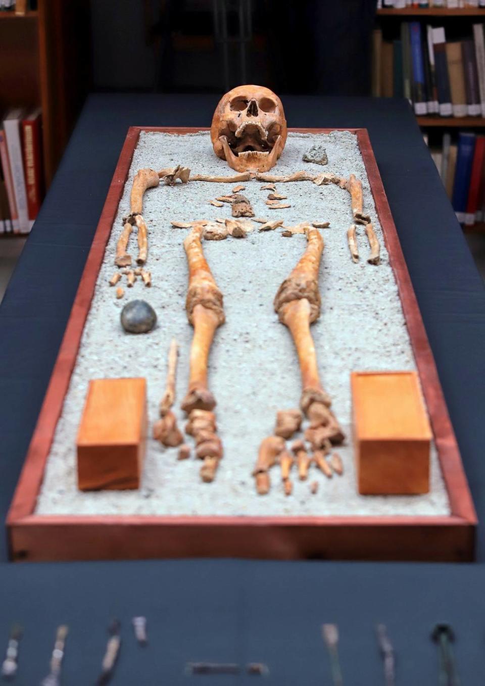 The physician’s skeletal remains on display