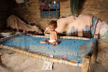 Malnourished Muath Ali Muhammad sits on a bed at his home in Aslam district of the northwestern province of Hajja