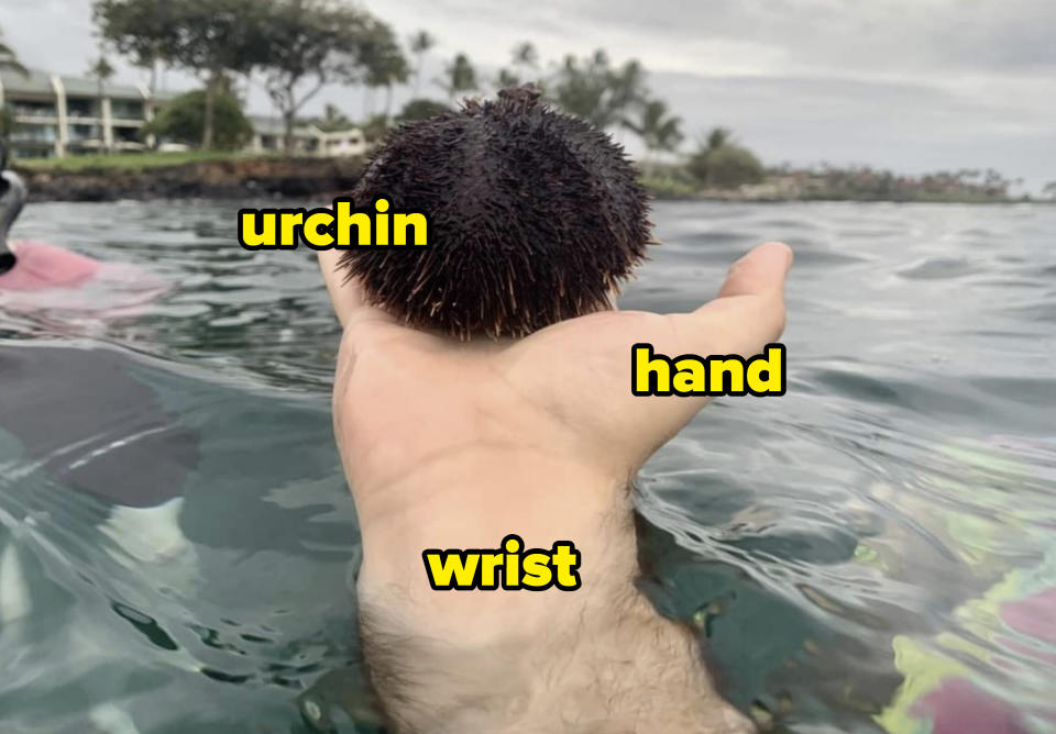 A man holding an urchin