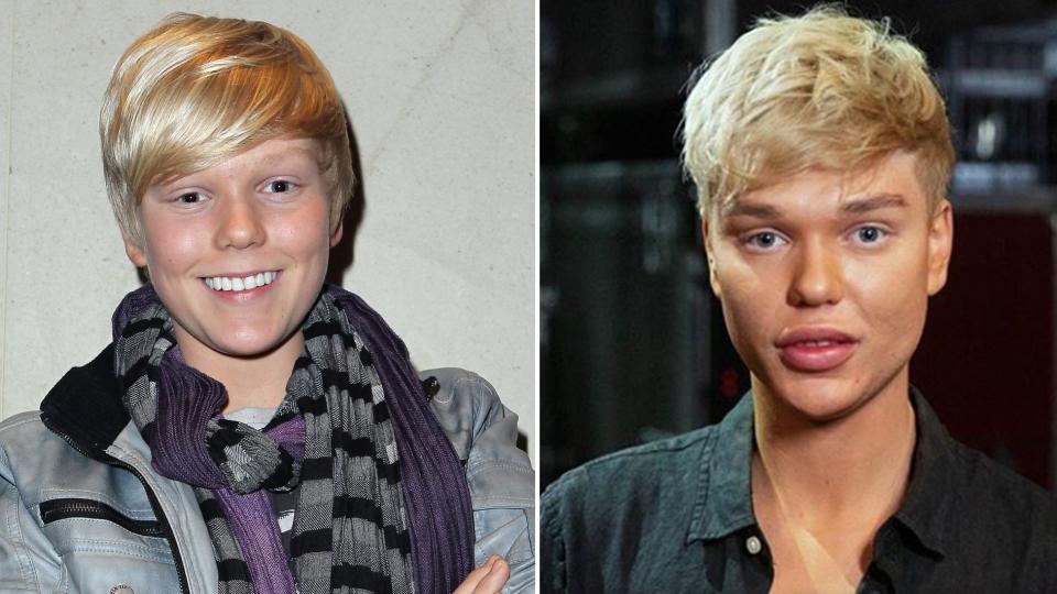 Jack Vidgen in 2011 (L) and 2019 (R). Photo: Getty (L) and Channel Nine (R) 