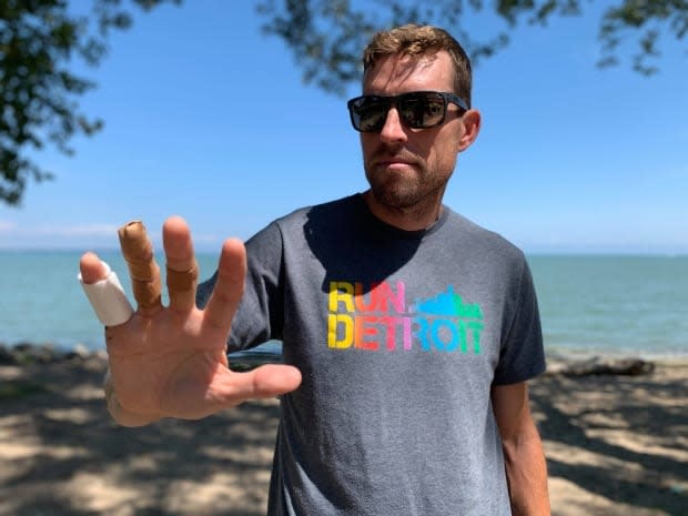 Matt Gervais, a Windsor triathlete, received 13 stitches from a presumed muskie bite while swimming in Lake St. Clair Aug 13.  (Darrin Di Carlo/CBC - image credit)