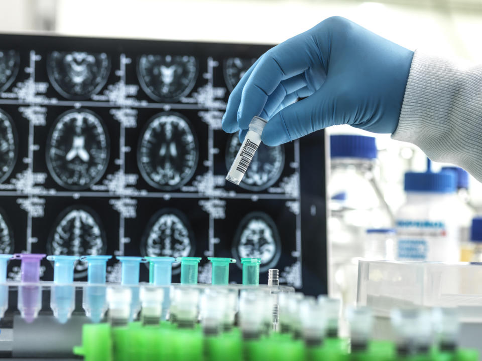 A hand in a blue glove holds a small vial with a bar code, in front of an array of brain scans on a computer screen.