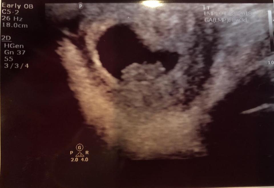 The rapper's mother shared a sonogram on Instagram.
