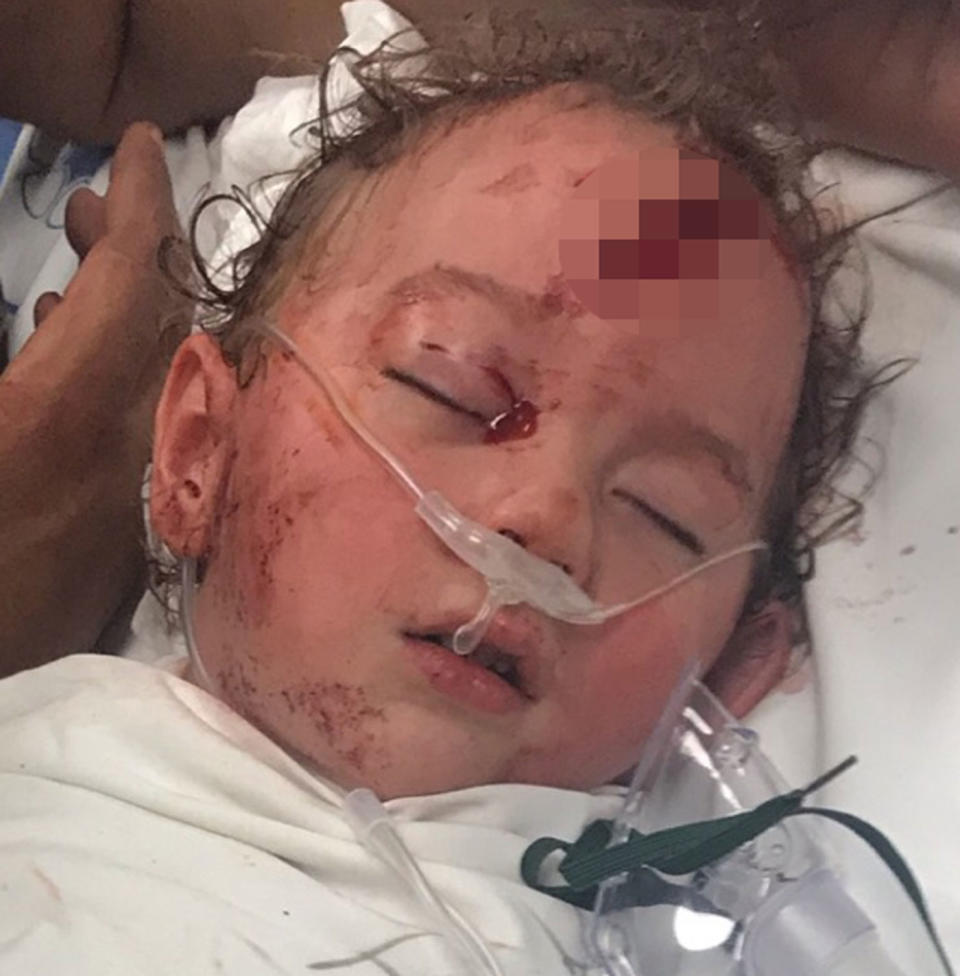Logan Grieve, 2, was playing in the backyard of his family home in Katherine, Northern Territory, when he was mauled by his family's Bull Mastiff cross. Source: Supplied/ Shannon Coutts
