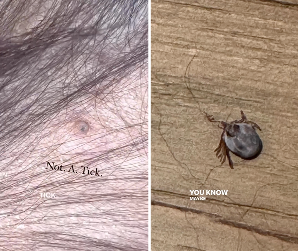 A dog's nipple / a tick.