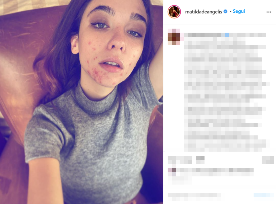 Matilda De Angelis (Foto dal profilo Instagram)