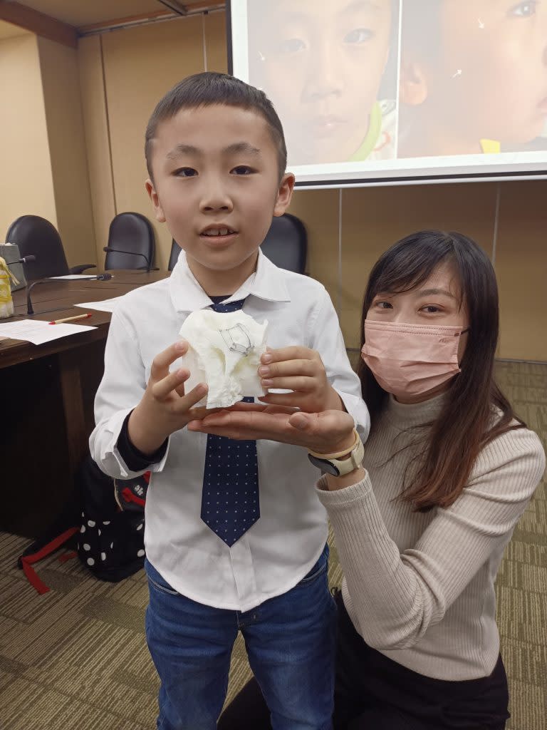 陳小弟6歲時發現右側顴骨有一顆直徑約1.7公分的腫瘤，經台北榮總以3D列印手術導引模型成功治癒，臉上完全沒有留下任何疤痕。（記者傅希堯攝）