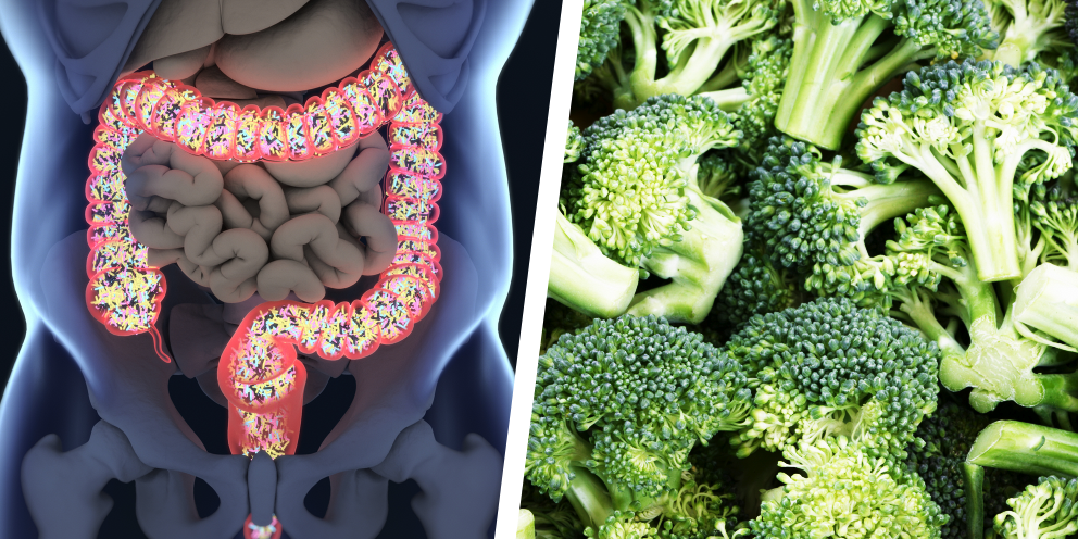 illustration of colon on left, photo of broccoli on right