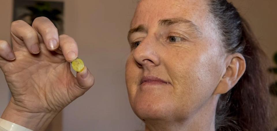 紐西蘭一名婦女，在鼻腔內發現37年前小玩具。（圖／翻攝自Stuff）
