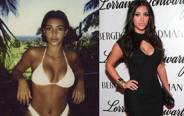 kim kardashian before and after plastic surgery body