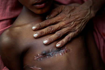 Mohammed Shoaib, 7, who was shot in his chest before crossing the border from Myanmar in August, is held by his father outside a medical centre near Cox's Bazar, Bangladesh November 5, 2017. REUTERS/Adnan Abidi