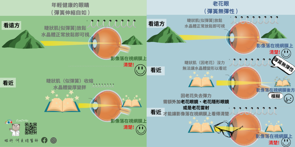 老花眼有如失去彈力的彈簧。