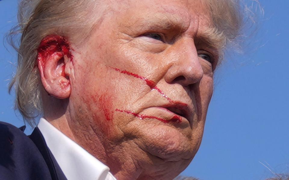 Trump covered in blood
