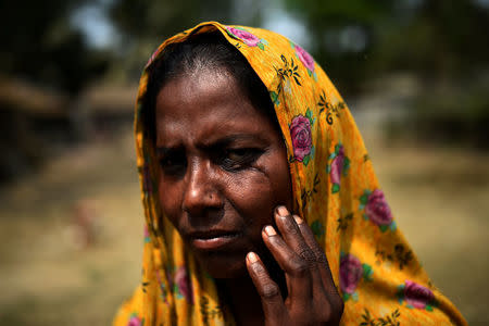 Hasina Begum, 30, a Rohingya refugee, poses for a photograph at Nazirartek fish drying yard in Cox's Bazar, Bangladesh, March 23, 2018. "I was wounded by a sword to my face," said Begum, describing how she fled her home. "Then I lost consciousness and I was lying on the ground and some of my neighbours took me to the boat and we crossed the river to the Bangladesh border." Eventually she moved out of a refugee camp to take up the fish-drying work. "Yes, it's a better life, as I can work here with drying fish and I can earn money," she added. REUTERS/Clodagh Kilcoyne