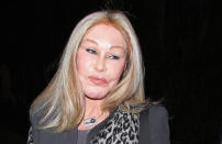 Jocelyn Wildenstein has been in the public eye for many years - and she's previously denied rumors that she'd gone under the knife. Instead, she explained that her "high cheekbones and long hair" stemmed from her Swiss background. Fashion designer Lloyd Klein added: "Jocelyn always looked like that. She never really did anything to change her face."