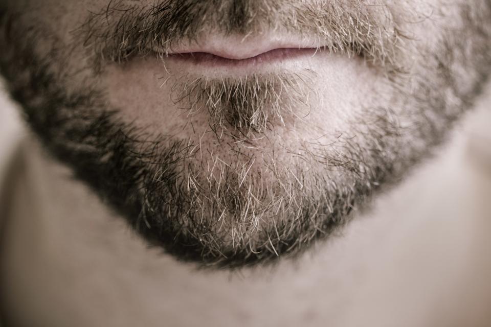 Facial-Hair Transplant