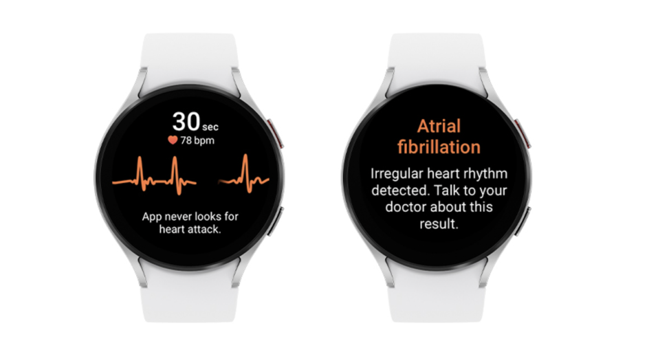 An image depicting Samsung's irregular heart rhythm feature on a galaxy watch