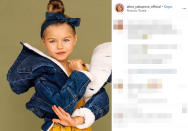 Yakupova è rappresentata dall'agenzia di moda per bambini, President Kids (PK) Management, la stessa che seguiva un'altra giovane modella russa, Anastasia Knyazeva. Quest'ultima si era guadagnata nel 2016, all'età di 6anni, lo scettro di "bambiba più bella del mondo". Prima di loro il titolo era nelle mani della modella francese Thylane Blondeau, figlia del calciatore Patrick Blondeau, che oggi ha 18 anni.