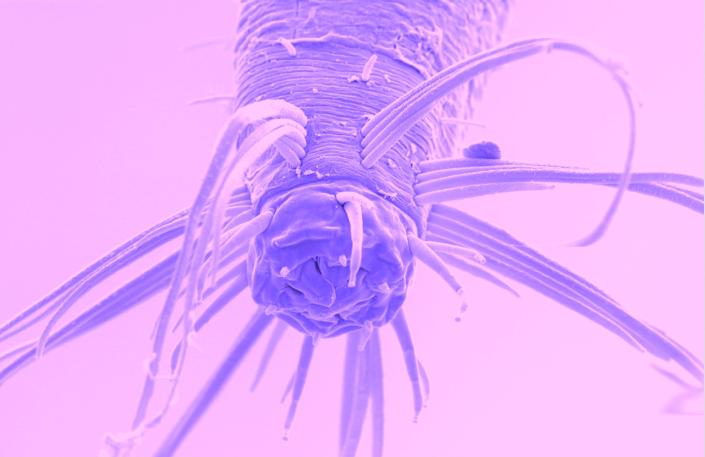 Imagen microscópica del nematodo theristus.