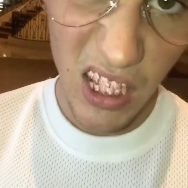 Justin Bieber flashes new grill.