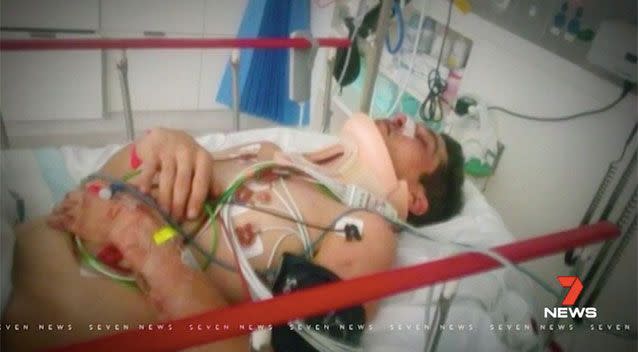 A Dandenong father thought he was going to die when he was savagely beaten by a gang of thugs. Source: 7 News